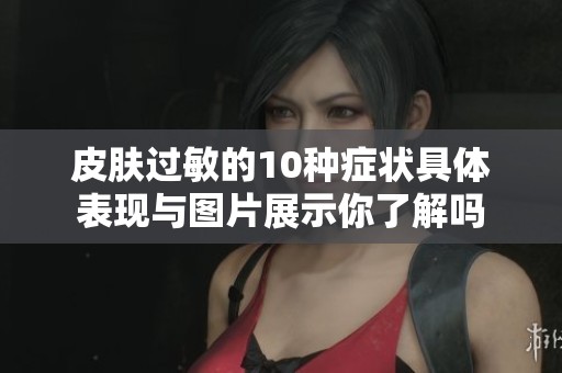 皮肤过敏的10种症状具体表现与图片展示你了解吗